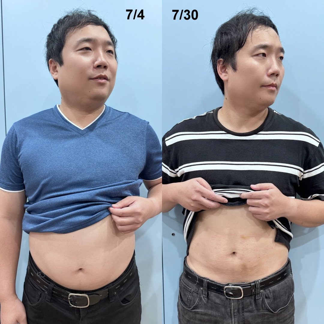 一個月減重7公斤有感!澤予堂成祐中醫診所埋線+中醫調理實測分享,含InBody變化分析 @猴屁的異想世界 一個月減重7公斤有感!澤予堂成祐中醫診所埋線+中醫調理實測分享,含InBody變化分析 @猴屁的異想世界